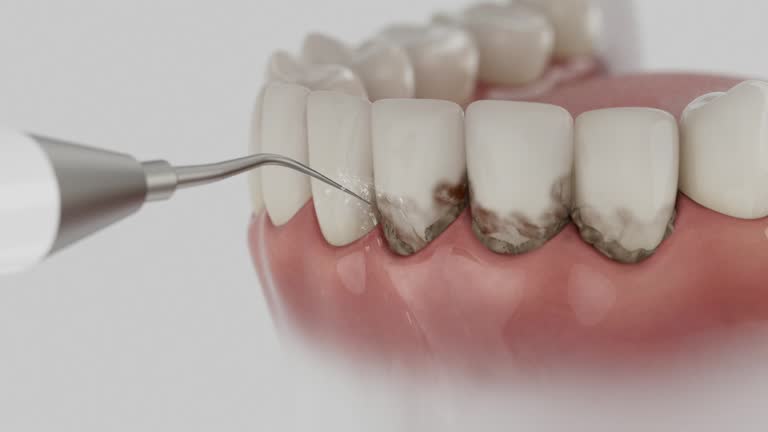 Trusted Invisalign Clear Aligners service in Olivet, NJ - Dentist Open Now
